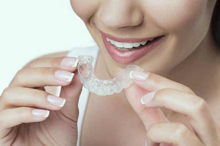 Close up of female mouth wearing clear aligner on teeth for orthodontic correction of bite. She is smiling